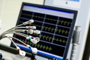 ECG Wires Connector cables and display of an electrocardiogram (or ECG) machine at Optimal Health Management, Sydney.