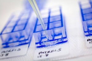 Pipette Preparing samples in the fight against childhood cancer. Children's Cancer Institute Australia.